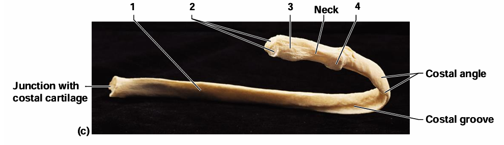 <p>What is #4 in the diagram?</p>