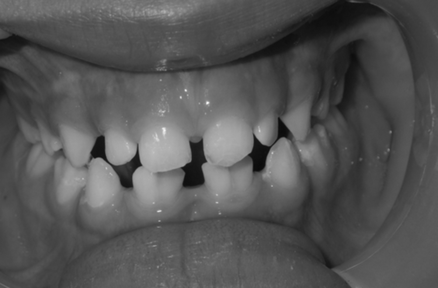 <p>ID the tooth anomaly:</p>