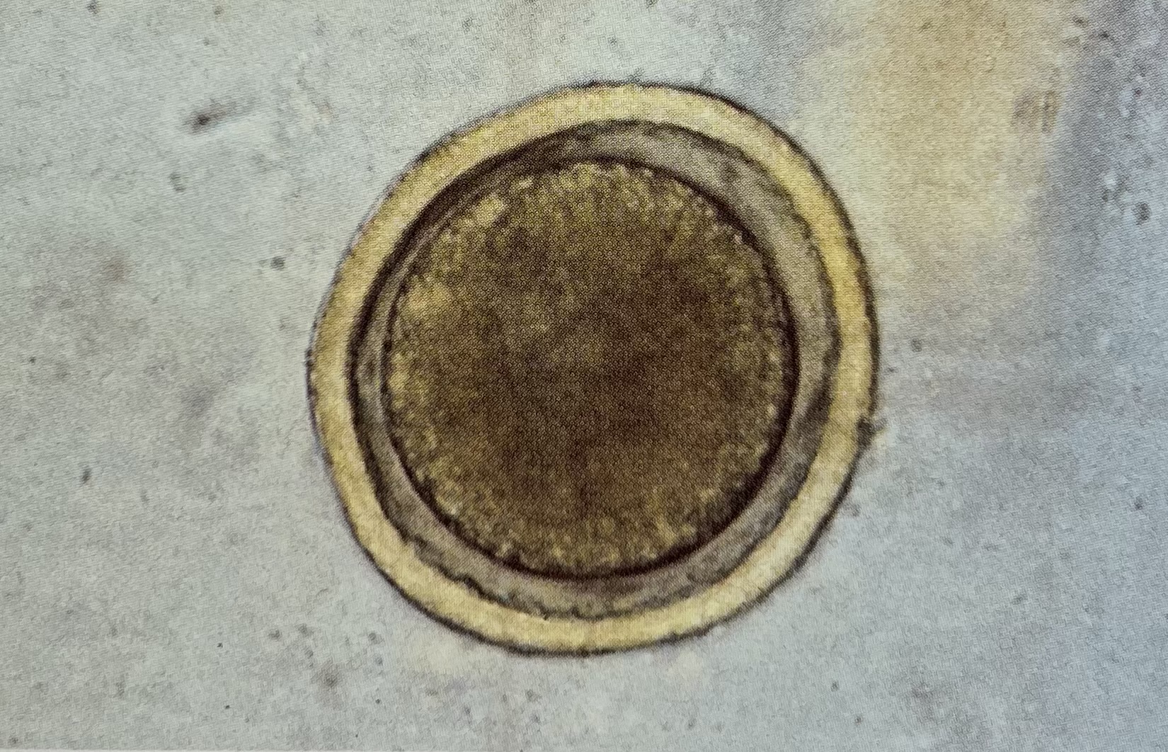 <p>What egg is this? (Smaller: 65-75um)</p>