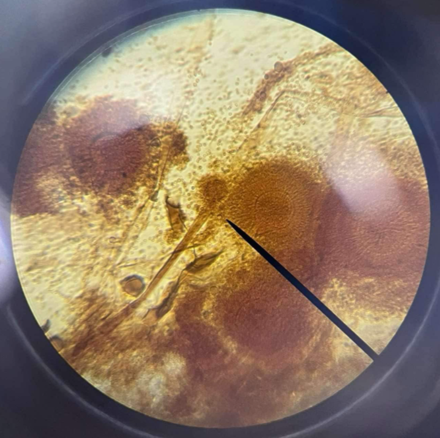 <p>Ascomycota; look like dandelions; septated hyphae</p>