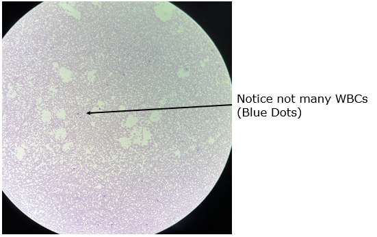 <p>What type of blood slide is this?</p>