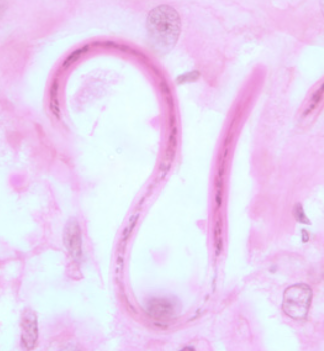 <p>What organism is this?</p>