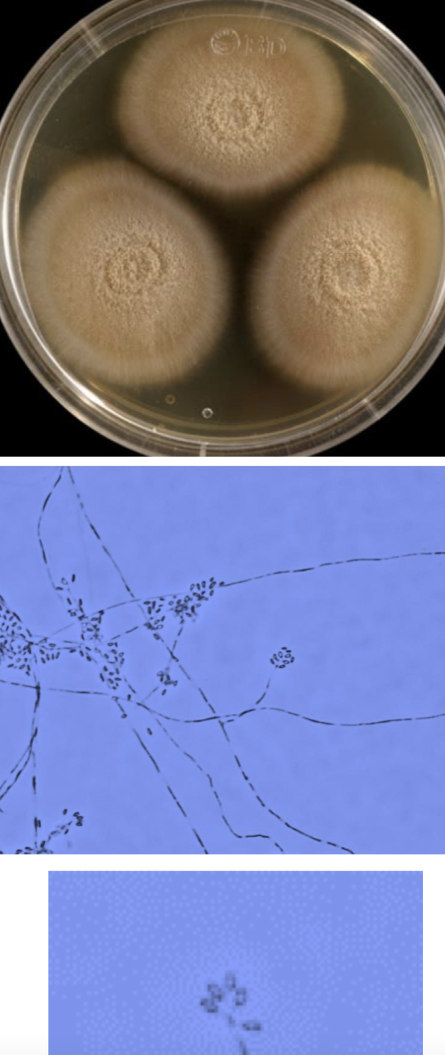 <p>Sporothrix schenckii mold</p>