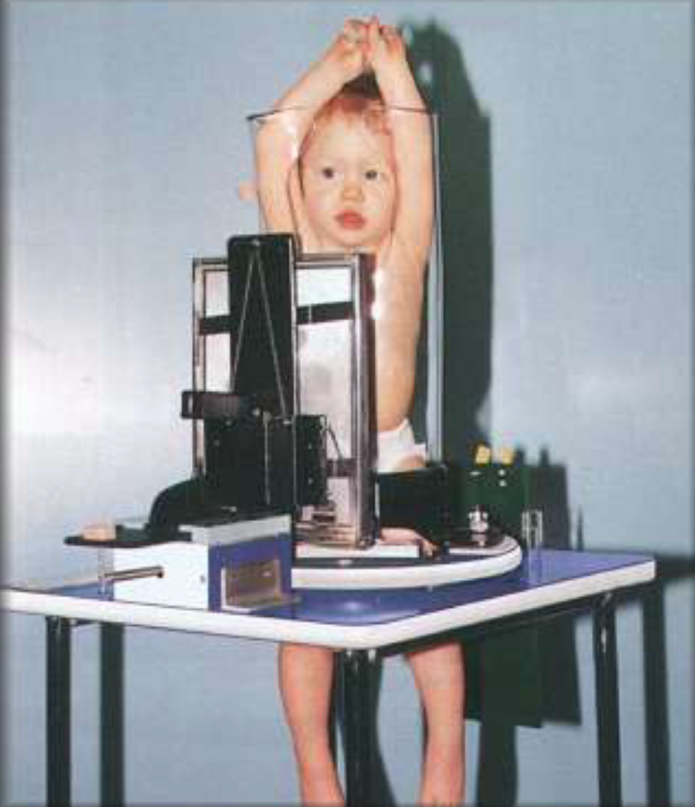 <p>What immobilization is this</p>