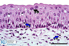 <p>Structure: Dome shaped cells on top, polyhedral cells in the middle, and cuboidal/columnar near basement</p>