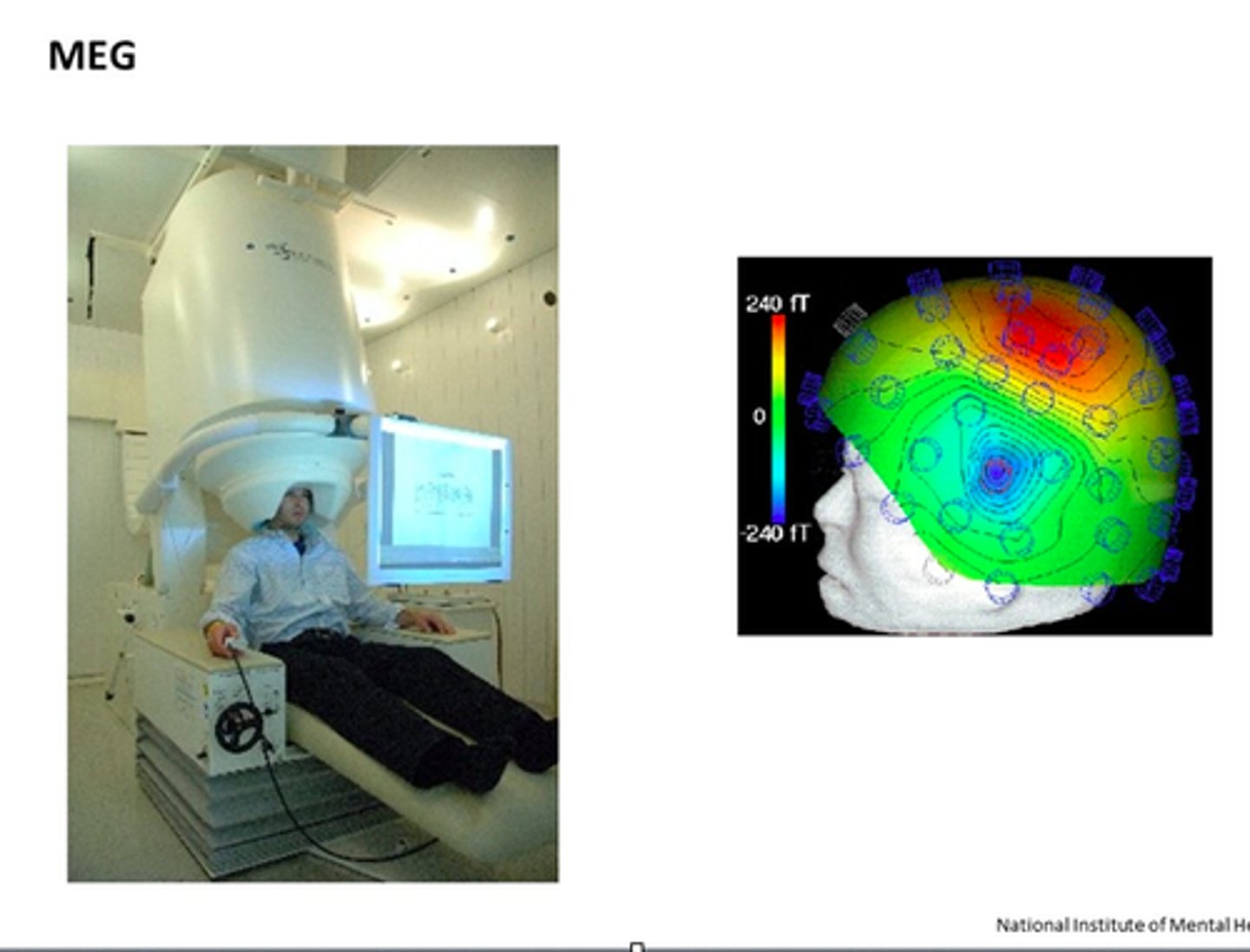 <p>- similar to EEG, it measures the magnetic field generated by brain activity</p><p>- same limitation -&gt; cannot measure specific parts of the brain</p><p>- a little cleaner than EEG because electrical signals would have to travel through the bone/scalp to be read</p><p>bad spatial resolution (slightly better than EEG) -&gt; more expensive</p><p>very good time resolution (milliseconds): </p><p>- allows us to very quickly see how brain activity changes</p><p>- can show changes in consciousness (ex. sleep studies, epilepsy, comas, attention)</p>