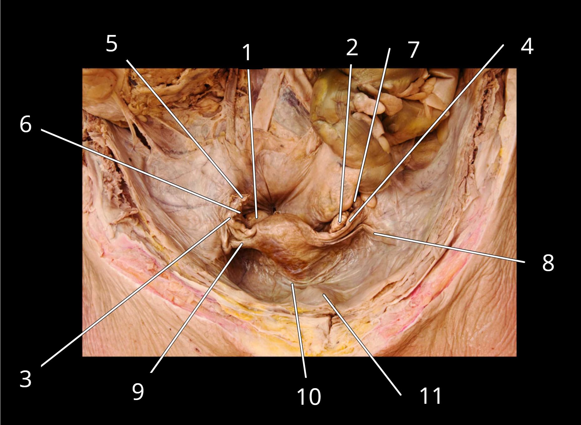 <p>Uterus </p>