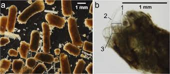 <p>40 to 80 µm… fecal origin</p>