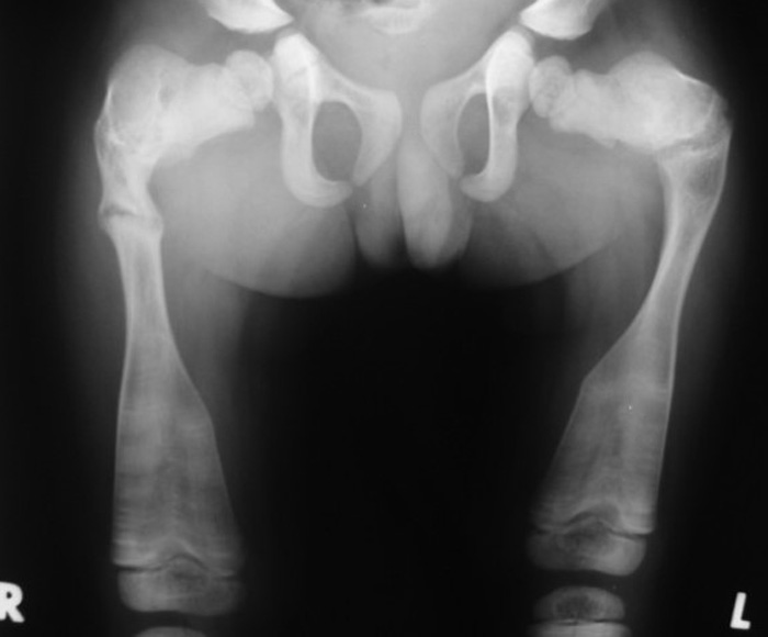 <p>What is the name of this pathology?</p>
