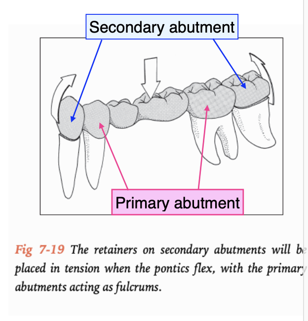 <p>in an unideal situation, sometimes you need to double-abutt, what are the requirements for the secondary abutment </p>