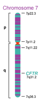 <p>autosomal ressessive condition, caused by mutations in the CF transmembrane conductance regulator gene, encodes protein expressed in the apical membrane of exocrine epithelial cells, locus 7q31.2, poor correlation between CFTR genotype and severity of lung diseasw suggests influence from secondary genetic characteristics and environmental factors </p>