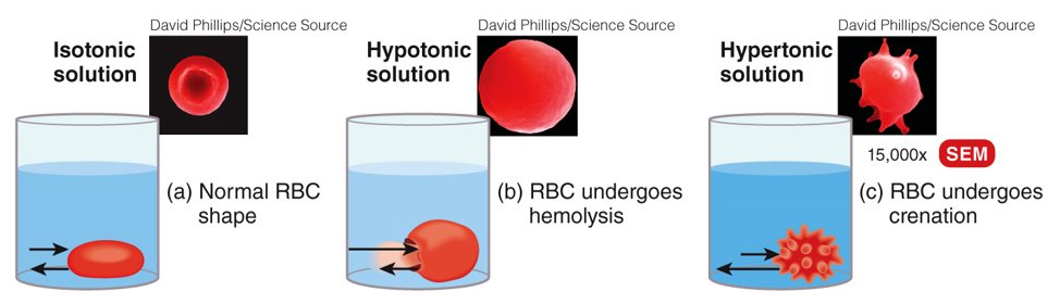 <p>isotonic (same conc. inside and outside the cell (ex. 0.9% NaCl)), hypotonic (conc. is higher inside cell than outside (ex. 3% NaCl)), and hypertonic (conc. is lower inside cell than outside (ex. 0.45% NaCl))</p>