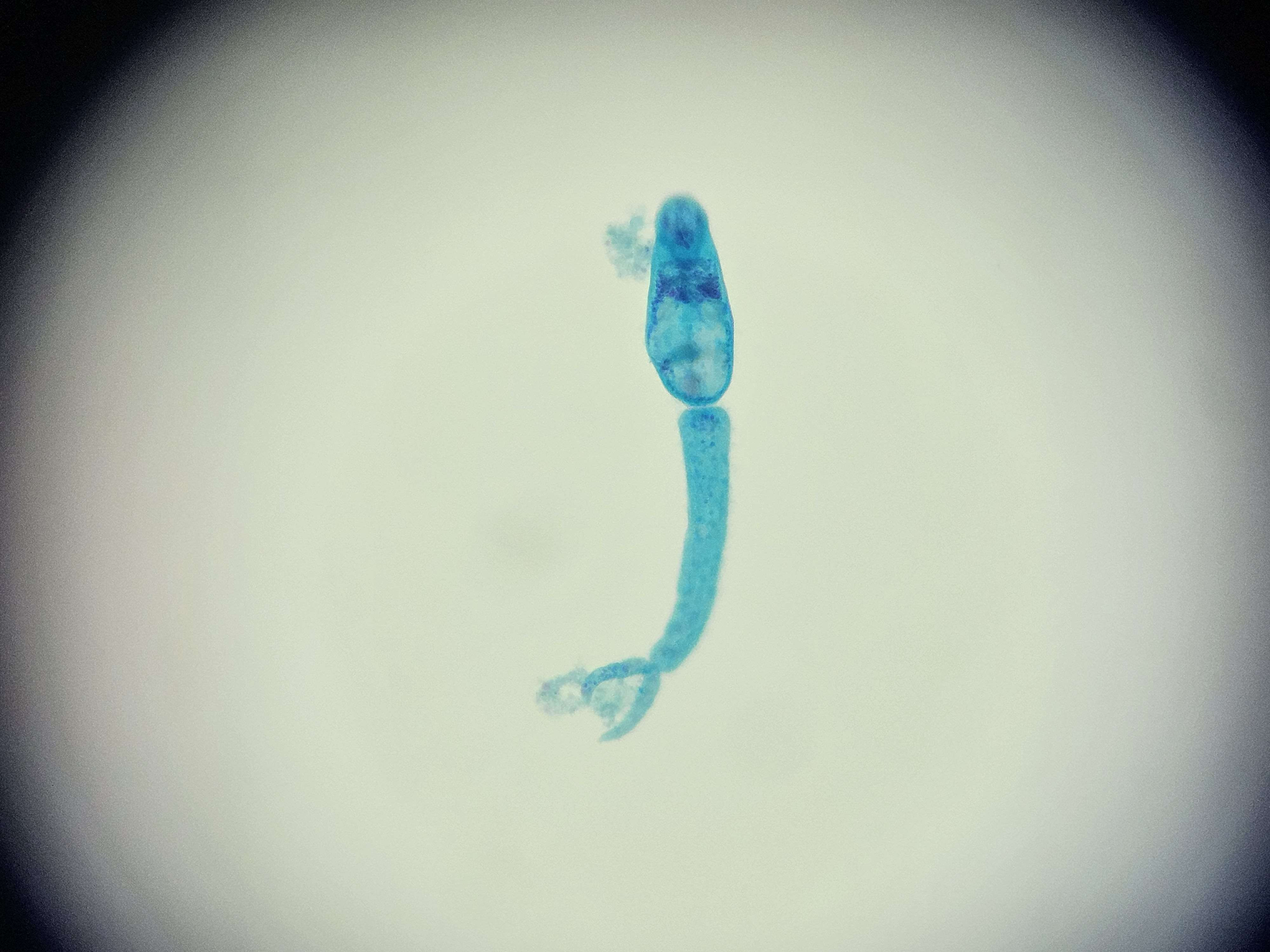 <p><span data-name="microscope" data-type="emoji">🔬</span><span data-name="petri_dish" data-type="emoji">🧫</span><strong><span> </span>Na podstawie zdjęcia preparatu:</strong></p><p></p><ul><li><p><span data-name="book" data-type="emoji">📖</span><span> </span>rozpoznaj gatunek pasożyta;</p></li></ul><p></p><ul><li><p><span data-name="recycle" data-type="emoji">♻</span><span> </span>rozpoznaj wszystkie formy rozwojowe;</p></li></ul><p></p><ul><li><p><span data-name="microbe" data-type="emoji">🦠</span><span> </span>wskaż organelle i cechy charakterystyczne dla danego gatunku;</p></li></ul><p></p><ul><li><p><span data-name="mask" data-type="emoji">😷</span><span> </span>nazwij chorobę, którą pasożyt wywołuje.</p></li></ul><p></p>