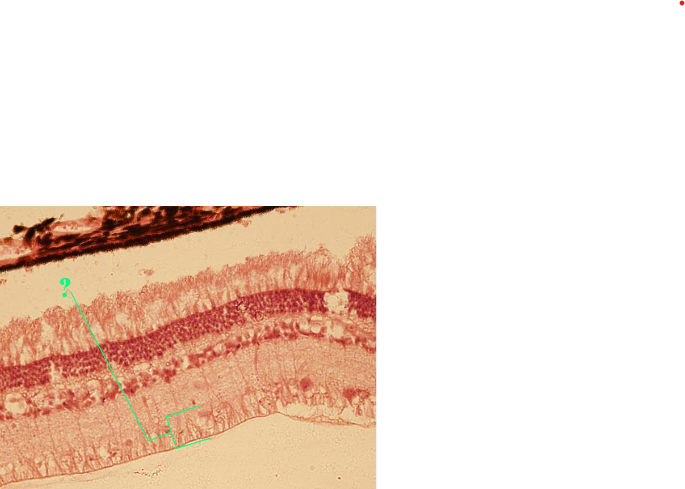 <p><span>Identify the indicated layer of the retina.</span></p>