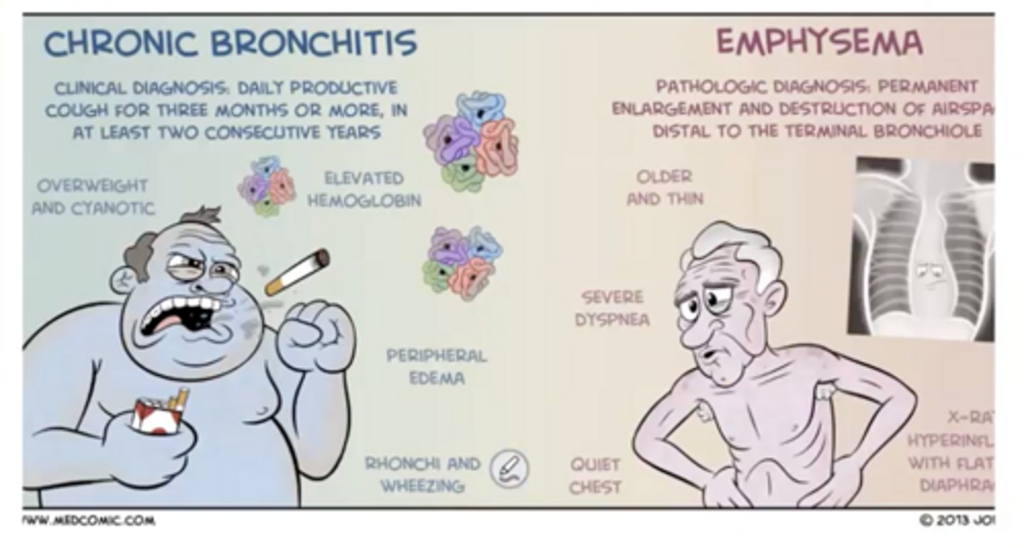 <p>Emphysema (alveolar wall destruction)</p>