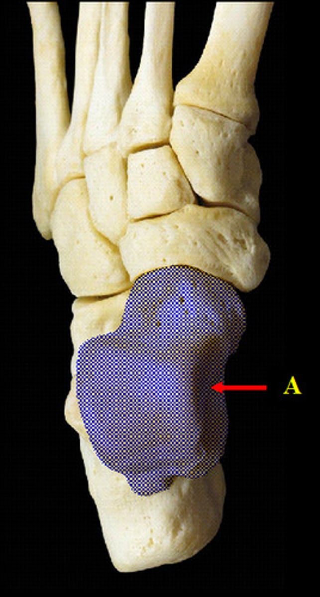 <p>Name this specific bone of the foot.</p>