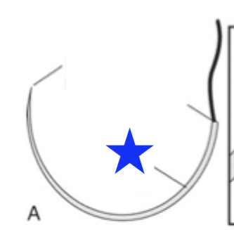 <p>What part of the surgical needle is indicated by the blue star?</p>