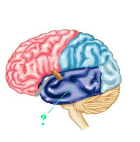 <p><span><span>Identify the indicated lobe of the brain</span></span></p>