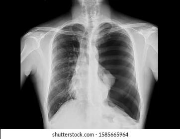 <p>Identify this pathology and state the symptoms</p>