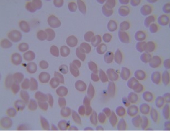 <p>Identify the alveolates. Causes malaria </p>