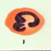 <p>Identify the WBC</p>