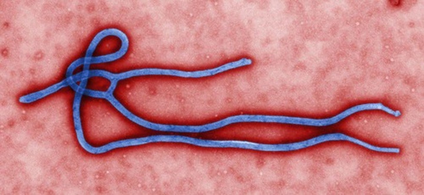 <p>Ebola viruses, members of the genus Ebolavirus</p>