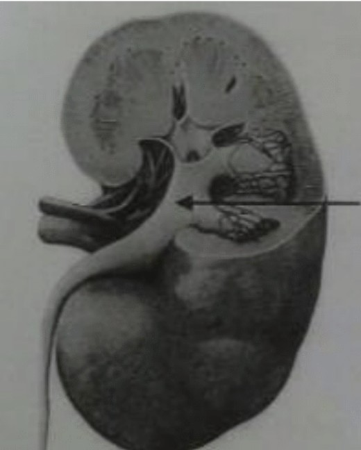 <p>Welche Struktur bezeichnet der Pfeil?</p><p>Pelvis renalis</p><p>Pyramides renales</p><p>Urether</p><p>A. renalis</p><p>Cortex renalis</p>