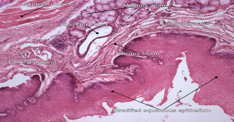 <ul><li><p>nonkeratinized stratified squamous</p></li><li><p>wet kind </p></li><li><p>interdigitated with LP under</p></li></ul>