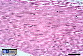 <p>Smooth Muscle Tissue — Description</p>