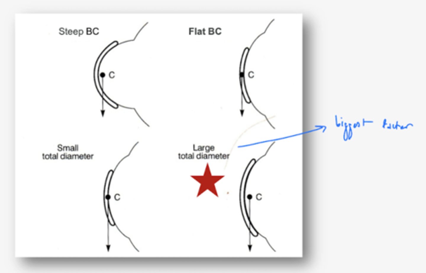 <p>lens diameter → 4-7x more important than thickness or power (size of lenses)</p>