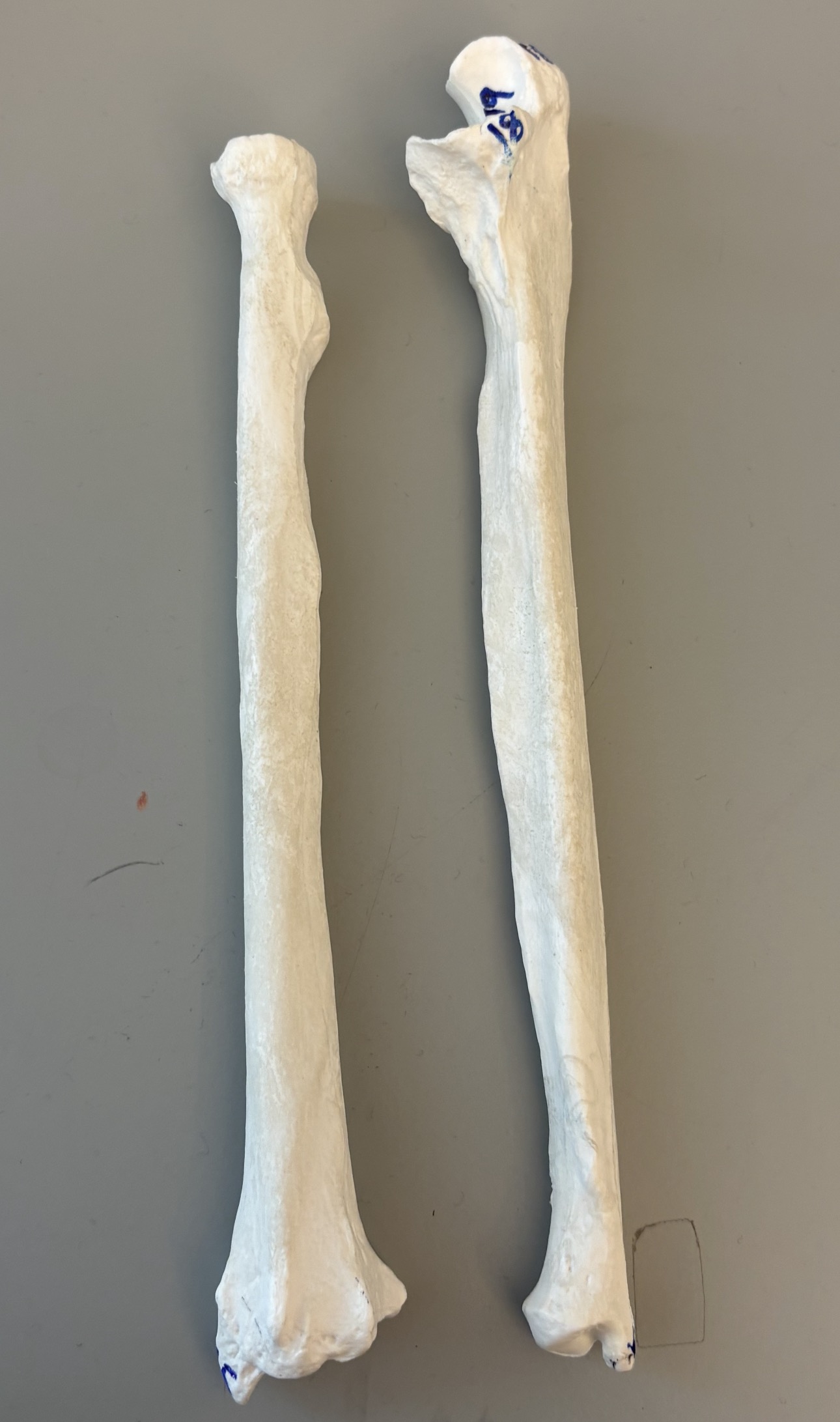 <p>what are these bones?</p>