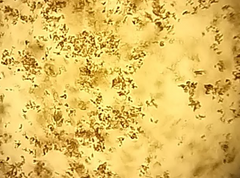 <p>What type of alkaline urine crystal is this?</p>