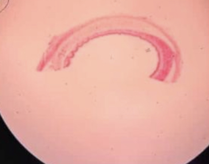 <p>Name the Tissue?</p>