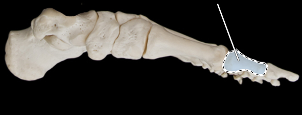 <p>Bones of the foot, medial view</p>