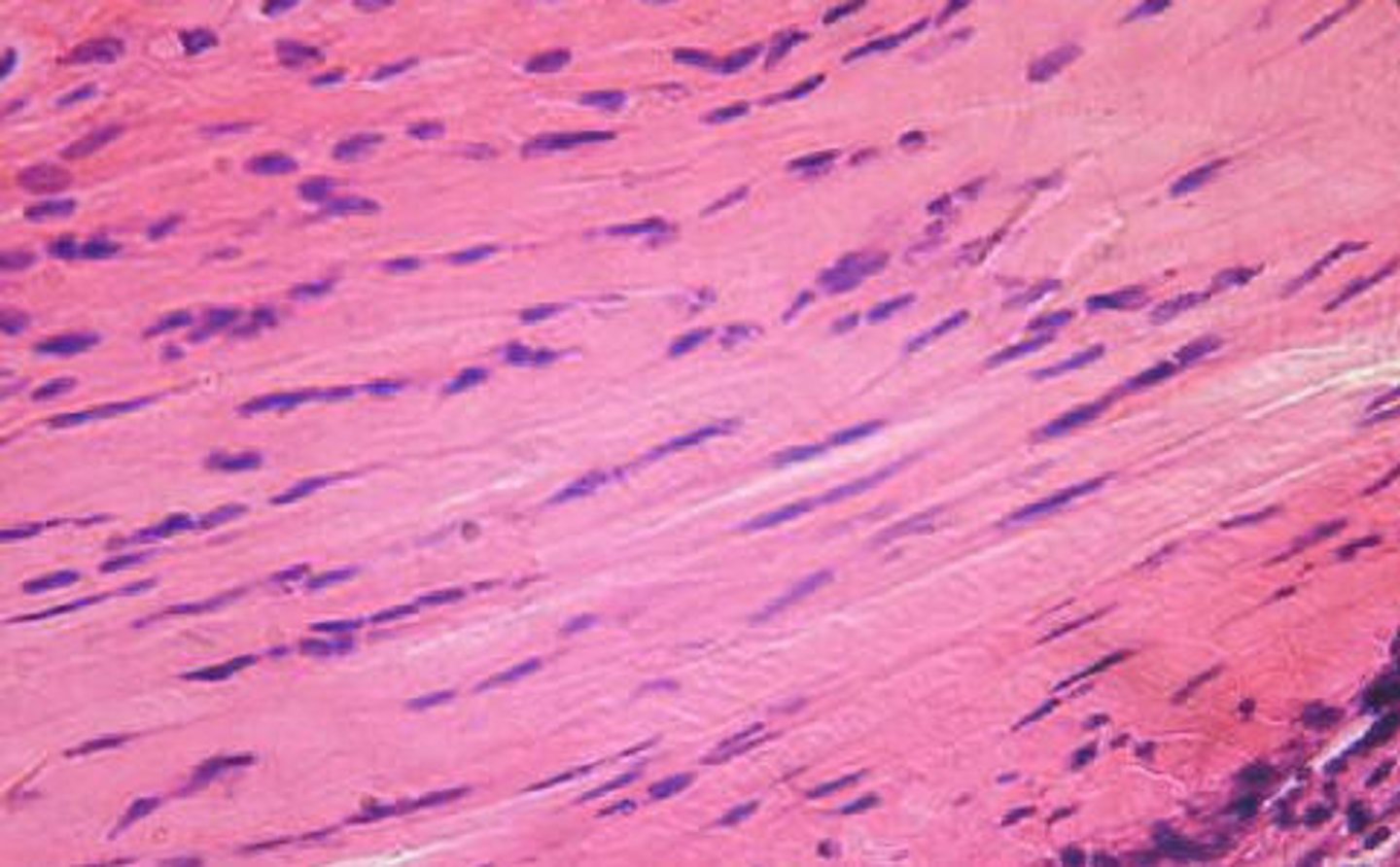 <p>- primarily parallel collagen fibers with few elastic fibers; main cell type is fibroblast</p><p>- attaches muscle to bones or to muscles; attaches bone to bone; withstands great tensile stress when pulling force is applied in one direction</p><p>- located in tendons, most ligaments, and aponeuroses</p>