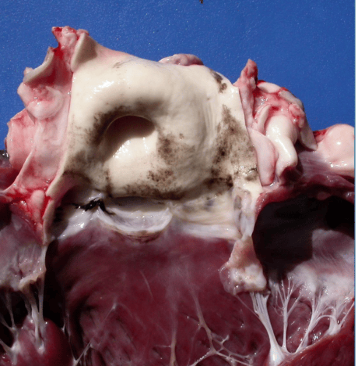 <p>is this a postmortem or antemortem pigment change?</p>