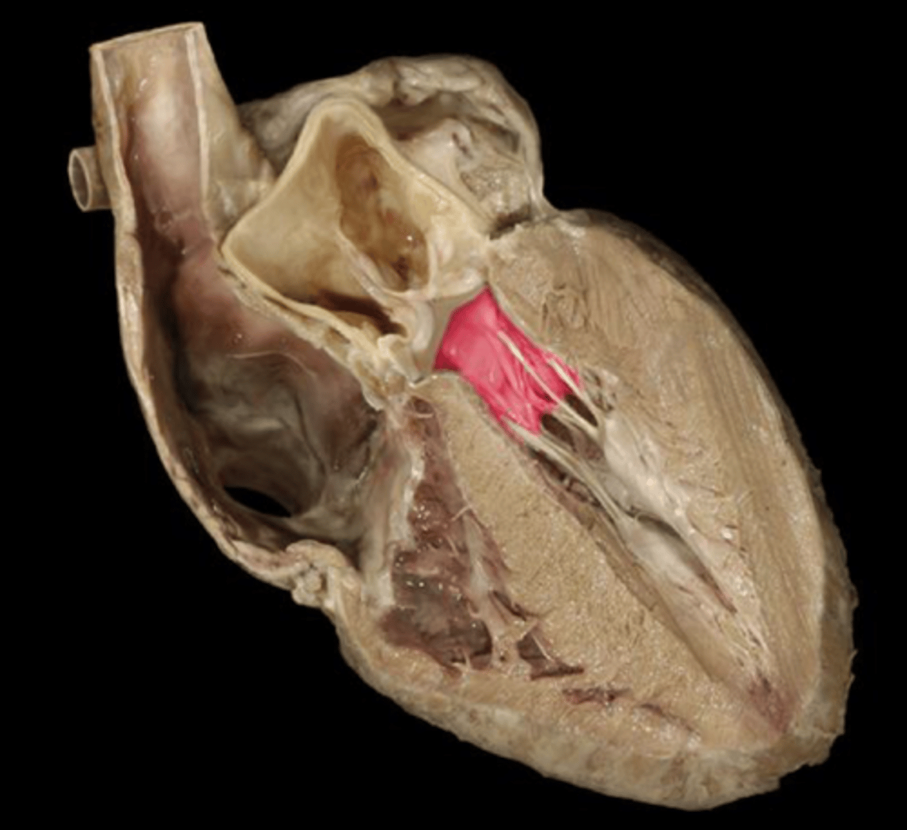<p>The valve located between the left atrium and left ventricle, preventing backflow of blood.</p>