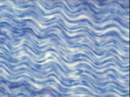 <ul><li><p>Densely packed, parallel fibers</p></li><li><p>Not much open space</p></li><li><p>Located in tendons and ligaments</p></li></ul><p></p>