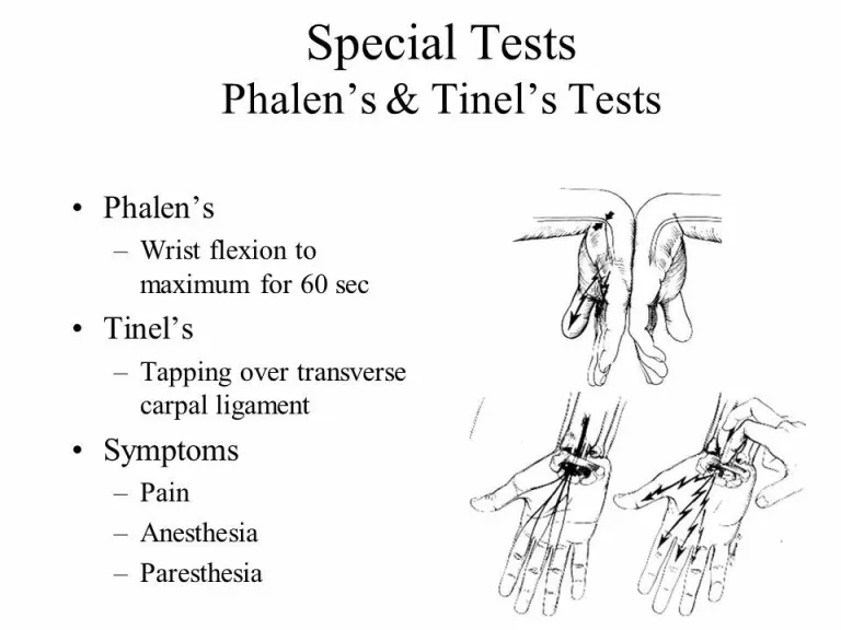 <p>Tinel's sign is performed by tapping over the median nerve at the wrist to check for tingling sensations, while Phalen's maneuver involves holding the hands in a forced flexed position for 30-60 seconds to see if symptoms are triggered</p>