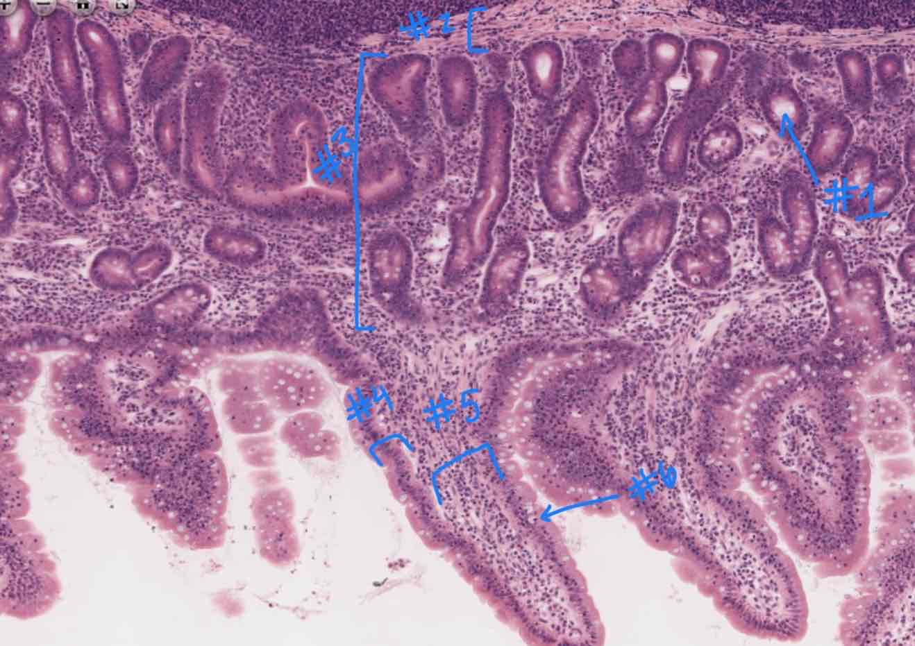 <p>What cell is #6 referring to?</p>