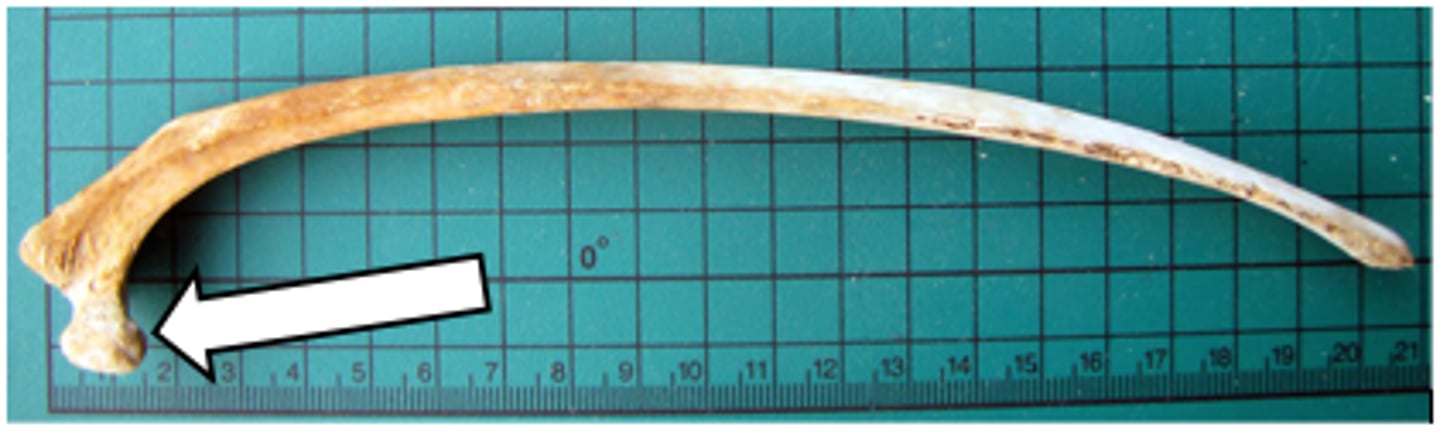 <p>Rib - vertebral articulation</p>