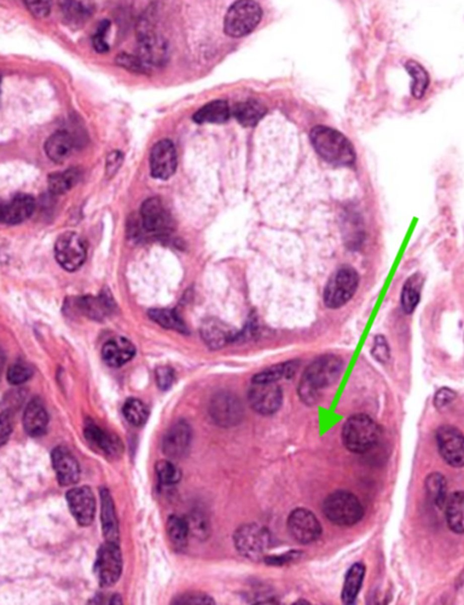 <p>Identify the gland in the mucosa and submucosa</p>