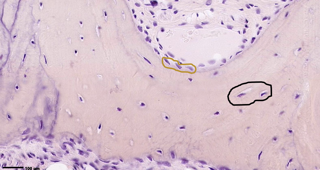 <p>ID the cells within the brown circle &amp; their marker enzyme. ID the cells within the black circle.</p>