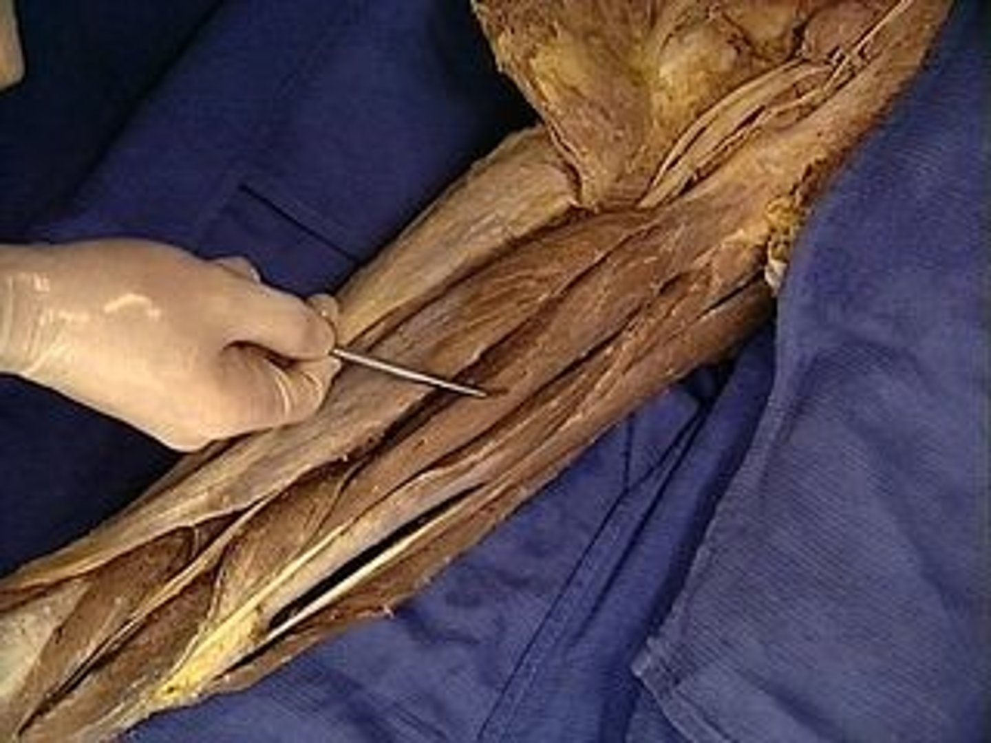 <p>Flexes leg at the knee and extends thigh at the hip; belongs to the hamstring group</p>