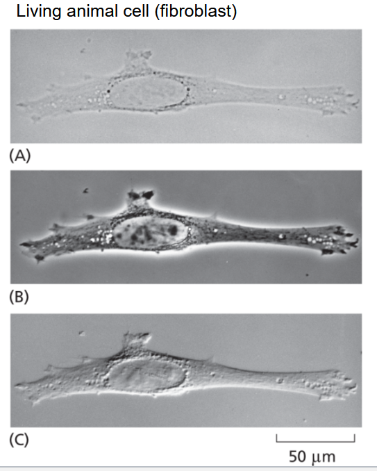 <ul><li><p>(A) Bright-field optics: has low contrast and usually needs staining.</p></li><li><p>(B) Phase-contrast optics: used for observing living cells and has halo effects.</p></li><li><p>(C) Interference-contrast optics: has 3D-like image, no halo effects, and enhanced edge contrast. Also relatively expensive.</p></li></ul><p></p>