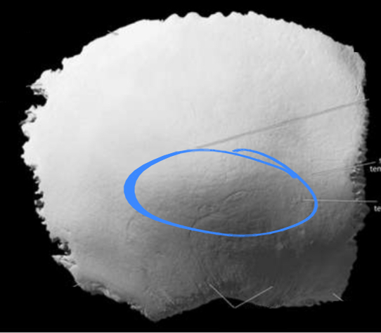 <p>Located on the parietal bone of the cranium</p>