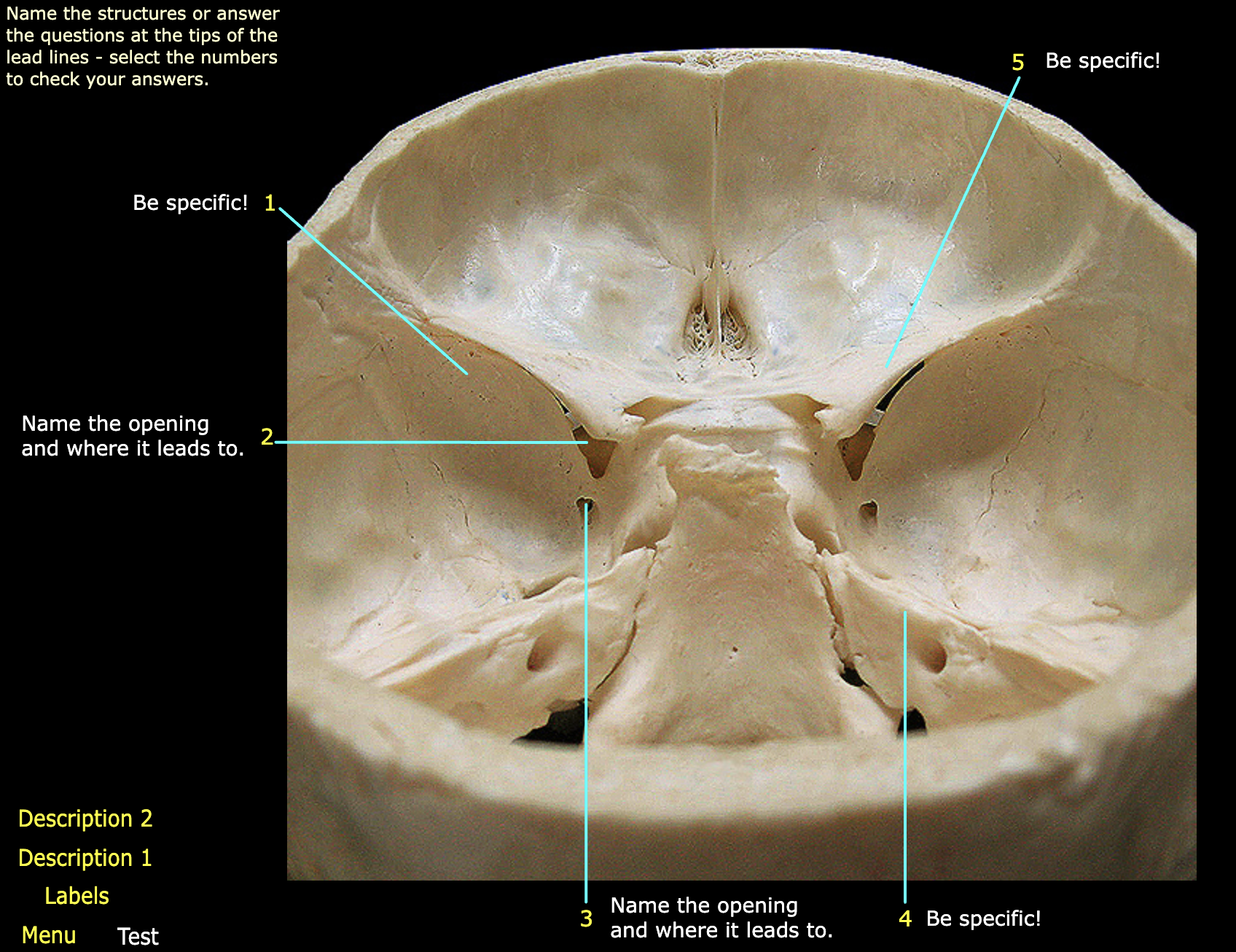 What structure is labeled 1?