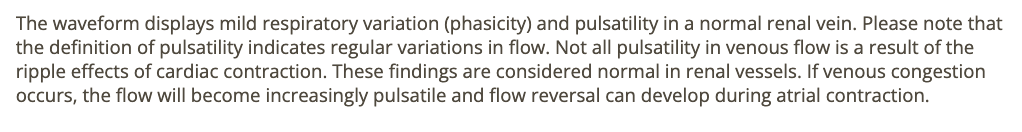 <p>c) mild phasicity + pulsatility </p>