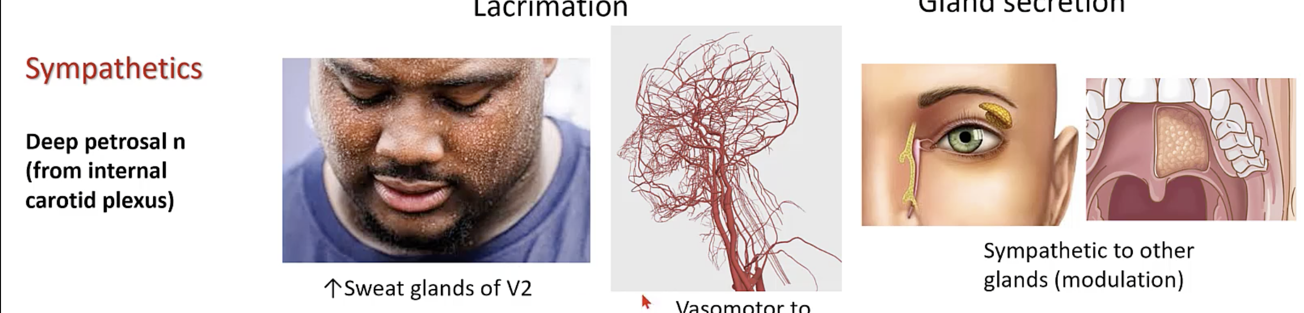<p>deep petrosal n (from internal carotid plexus)</p>