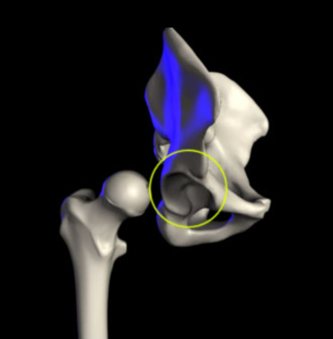 <p>What type of bone marking is this?</p>